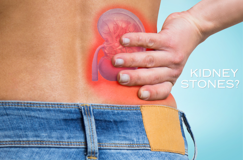 What Are Kidney Stones? Causes, Symptoms & Treatment Kidney Stones