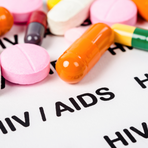 Hiv Aids